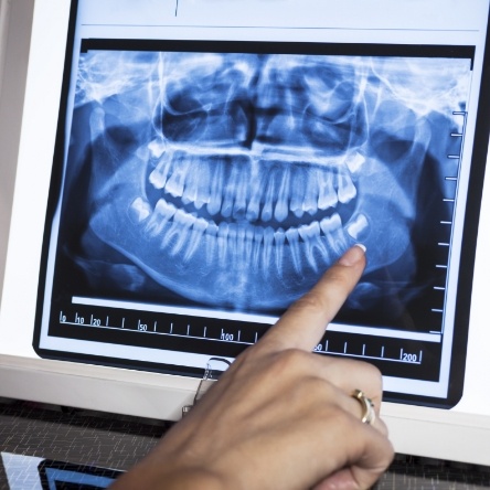 Dental assistant looking at x-rays on computer screen