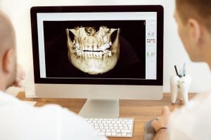 dentists looking a digital image of a mouth