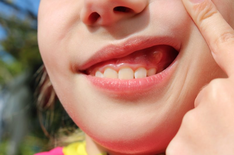 person with a bump on their gums in Mesquite