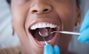 Nose to chin view of patient having oral examination